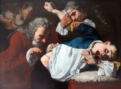 The Operation by Gaspare Traversi